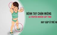 Thông điệp phòng chống tay chân miệng