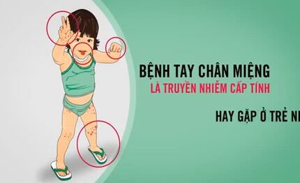 Thông điệp phòng chống tay chân miệng