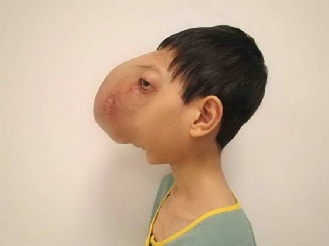 Giáo sư Mỹ mang điều kỳ diệu đến với cậu bé “không có mặt”