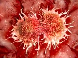 Các nhà khoa học Nga và Thụy Điển tìm ra cách diệt tế bào ung thư