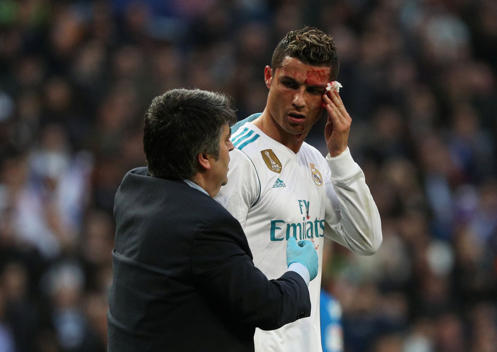 Ronaldo chảy máu sau nỗ lực ghi bàn nâng tỉ số lên 6-1. Ảnh: Reuters