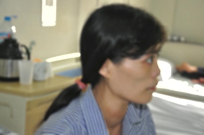 Cảnh báo nguy cơ hoại tử vùng cổ vì chữa bệnh basedow bằng thuốc Nam