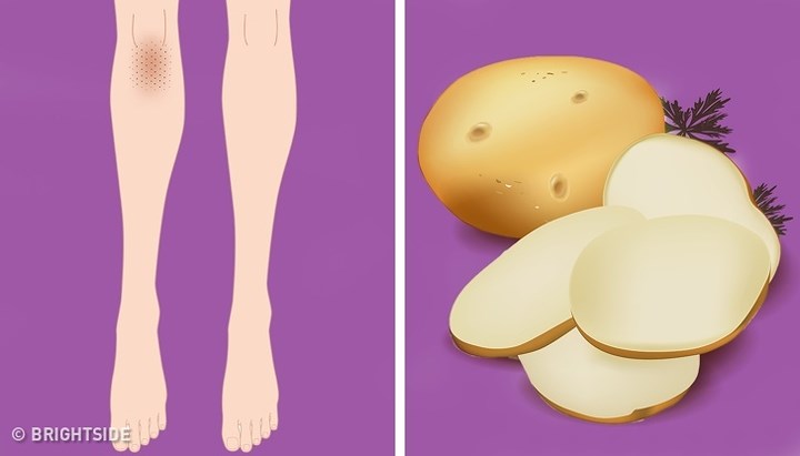 Khoai tây giàu enzyme catecholase có thể làm sáng màu da tự nhiên. Việc sử dụng khoai tây hàng ngày sẽ làm mềm da và loại bỏ những vùng da tối màu. Bạn có thể chà khuỷu tay và đầu gối bằng cách cắt khoai tây thành lát trong khoảng 10-15 phút và sau đó rửa sạch.