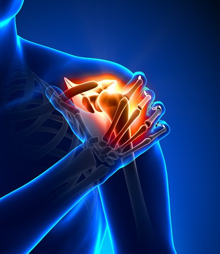Cơn đau lan đến cánh tay: Nhiều người có cảm giác bị đau ở cánh tay trái, trong khi phụ nữ thường bị đau ở cả hai cánh tay. Một số phụ nữ cho biết họ có một cơn đau khuỷu tay bất thường trước khi bị đau tim. Điều này xảy ra vì cơn đau từ tim di chuyển đến tủy sống nơi có nhiều dây thần kinh của cơ thể được kết nối và não của bạn bị rối loạn và nghĩ rằng cánh tay của bạn đang bị đau nhưng thực sự không phải như vậy.