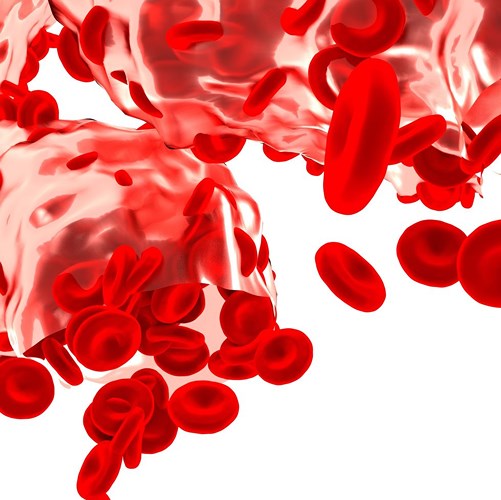 Rối loạn đông máu: Bệnh Hemophilia (máu khó đông) và Von Willebrand (rối loạn đông cầm máu) là cả hai rối loạn máu có thể gây bầm tím dễ dàng. Bệnh máu khó đông là một tình trạng hiếm gặp ảnh hưởng đến khả năng đông của máu, khiến cho ai đó có nguy cơ chảy máu nghiêm trọng chỉ vì một chấn thương nhẹ. Bệnh rối loạn đông cầm máu là một rối loạn đông máu nhẹ hơn và phổ biến hơn, người bệnh thường chảy máu trong khi làm răng, chảy máu cam lâu, có máu trong nước tiểu hoặc phân.