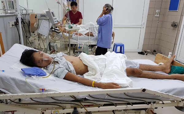 Nhiều người chết vì ong đốt: Cách sơ cứu loại nọc độc đơn giản ít ai biết