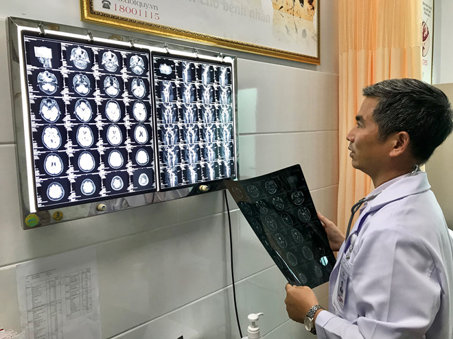 TS-BS Trần Chí Cường đọc phim chụp MRI 3 Tesla của một bệnh nhân đột quỵ. Ảnh: Đình Tuyển