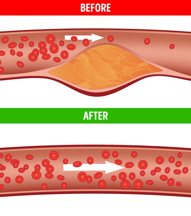 Giảm cholesterol: Đu đủ rất giàu chất xơ, chất chống oxy hóa và vitamin có tác dụng tốt trong việc ngăn ngừa bệnh tim, giảm lượng cholesterol.