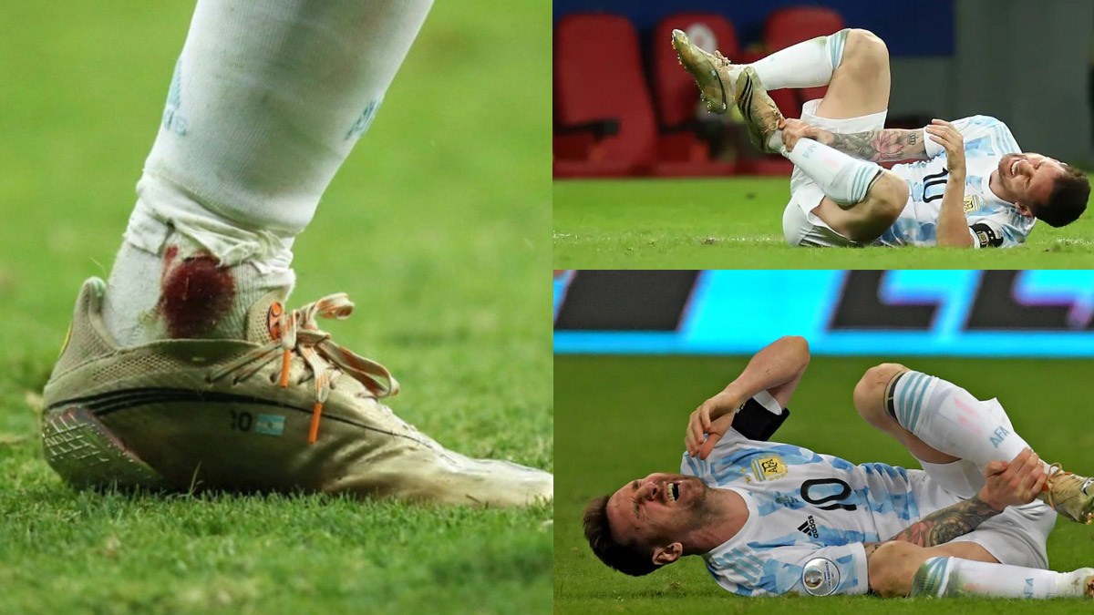 Messi đổ máu trên hành trình vào chung kết Copa America 2021