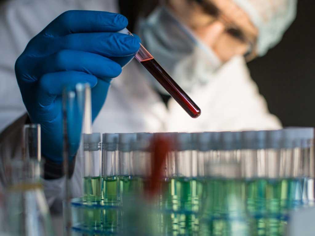 Xét nghiệm máu giúp phát hiện sớm hơn 50 loại bệnh ung thư Xét nghiệm này chỉ cần 2 ống máu của bệnh nhân và sẽ cho ra kết quả sau khoảng 10 ngày. MINH HỌA: SHUTTERSTOCK