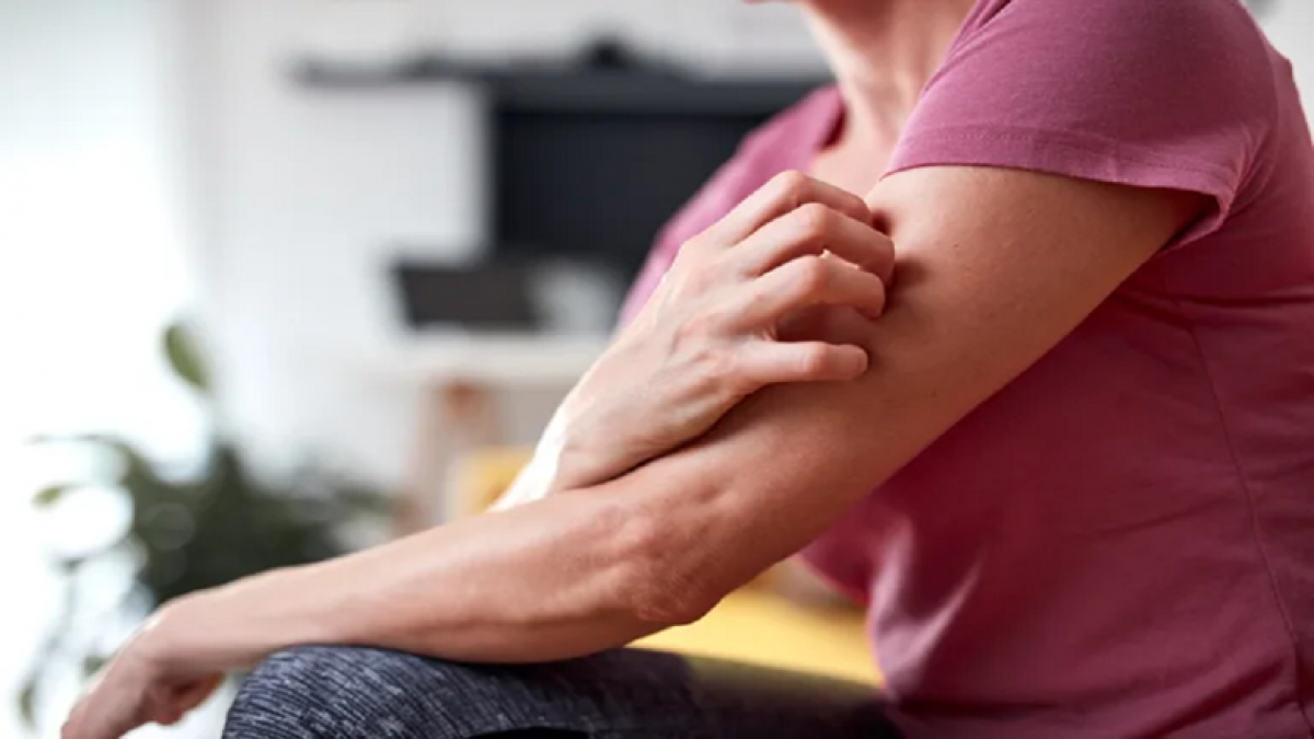 5 dấu hiệu trên da cảnh báo bệnh thận