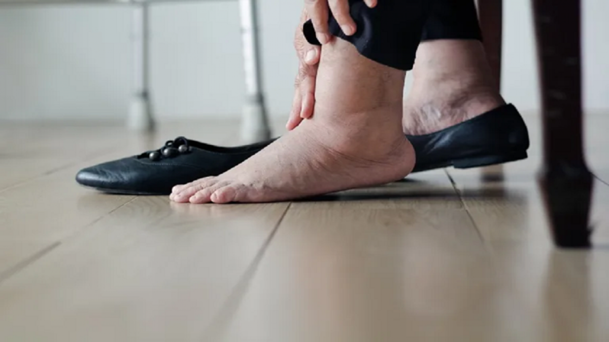 5 dấu hiệu trên da cảnh báo bệnh thận