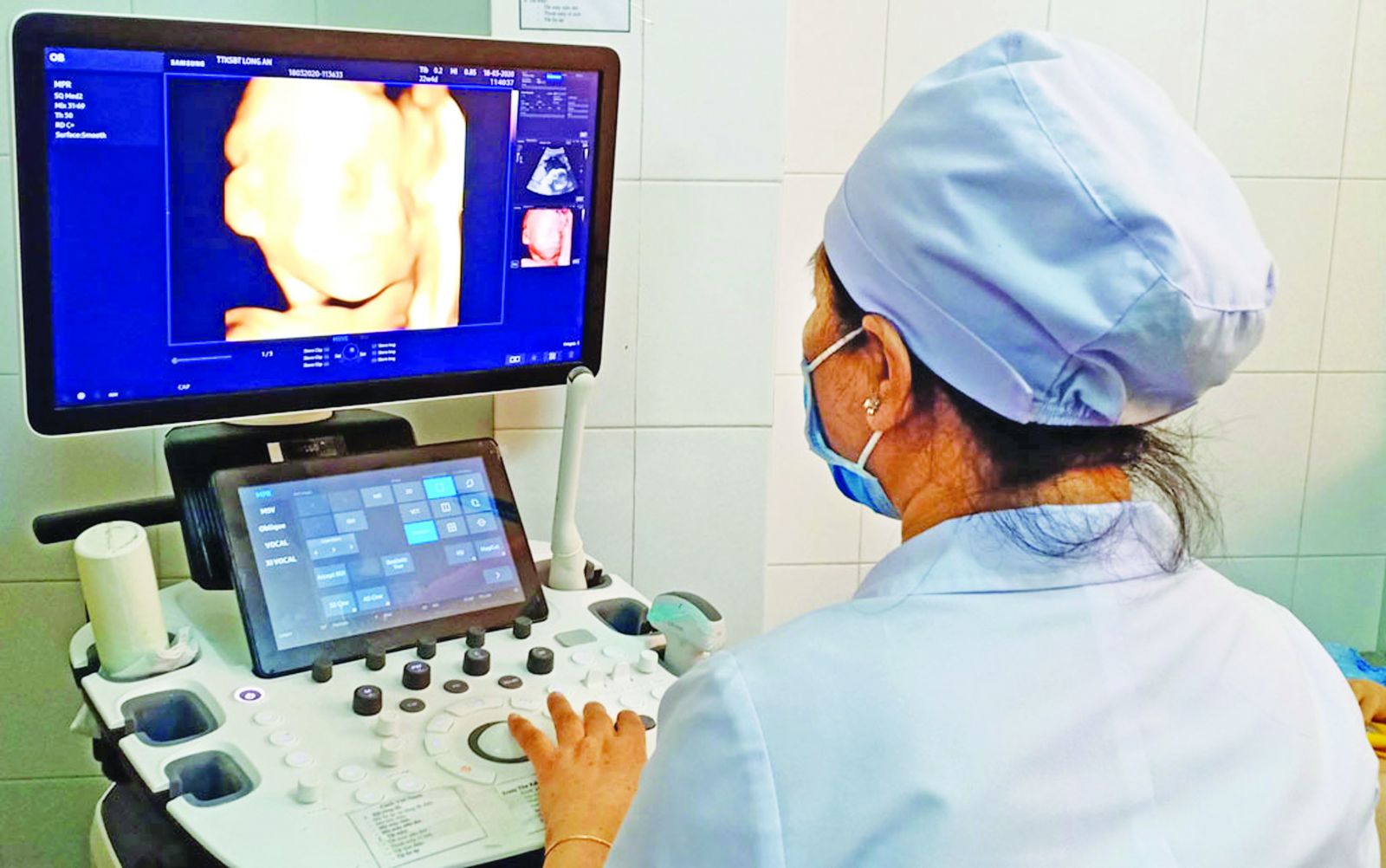 Nâng cao chất lượng dân số Thai phụ được siêu âm sàng lọc trước sinh Ảnh: Ng.Thạch