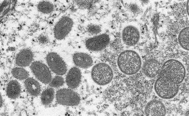 Hình ảnh virus đậu mùa khỉ dưới kính hiển vi. (Ảnh: AFP/TTXVN) Báo The Times của Ấn Độ ngày 19/8 đưa tin bộ xét nghiệm RT-PCR bệnh đậu mùa khỉ đầu tiên sản xuất trong nước đã được tung ra thị trường nước này.  Bộ xét nghiệm do công ty Transasia Bio-Medicals Ltd phát triển, đã được ra mắt tại khu công nghệ y tế Andhra Pradesh Medtech Zone.  [WHO nghiên cứu khả năng đột biến gene thúc đẩy đậu mùa khỉ lây lan]  Chủ tịch Transasia Bio-Medicals Ltd Suresh Vazirani cho biết bộ xét nghiệm này sẽ giúp chẩn đoán sớm và hỗ trợ cơ quan y tế có biện pháp ứng phó kịp thời với dịch bệnh trong bối cảnh Tổ chức Y tế Thế giới (WHO) đã tuyên bố đậu mùa khỉ là tình trạng khẩn cấp toàn cầu.  Theo báo cáo mới nhất của WHO, đến nay, có 32.000 ca mắc bệnh đậu mùa khỉ được ghi nhận tại 82 nước và vùng lãnh thổ chưa từng ghi nhận ca bệnh này, trong đó Mỹ là nước có số ca mắc đông nhất với hơn 14.000 ca./.