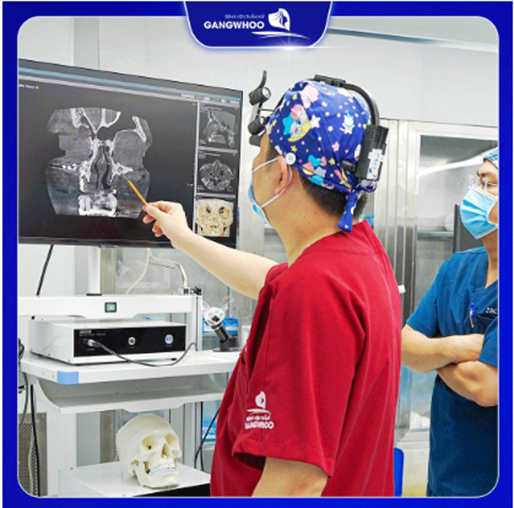 Phẫu thuật hạ gò má là gì, có nguy hiểm không?