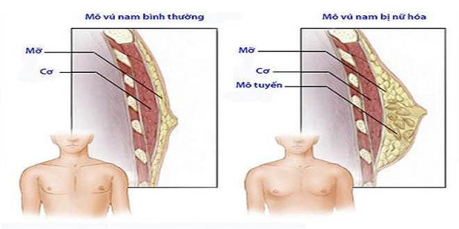 Nam giới sở hữu vòng 1 'khủng', có sao không?