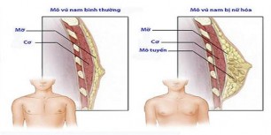 Nam giới sở hữu vòng 1 'khủng', có sao không?