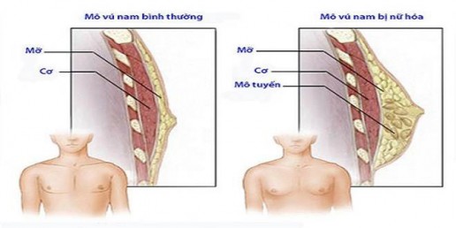 Nam giới sở hữu vòng 1 'khủng', có sao không?