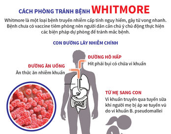 Cách phòng tránh bệnh Whitmore
