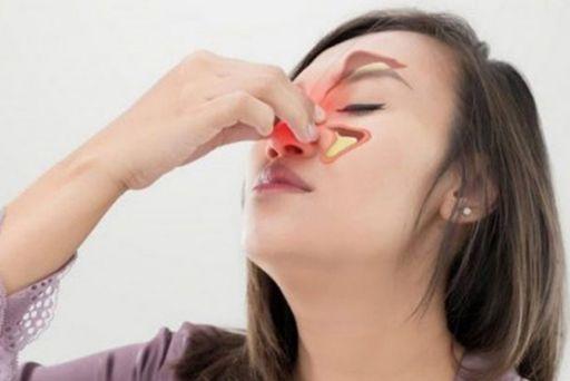 Chữa ngay viêm mũi, đừng để biến chứng viêm xoang xảy ra! Viêm mũi là tình trạng niêm mạc mũi bị tổn thương, viêm