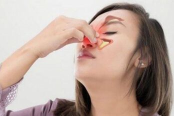Chữa ngay viêm mũi, đừng để biến chứng viêm xoang xảy ra!