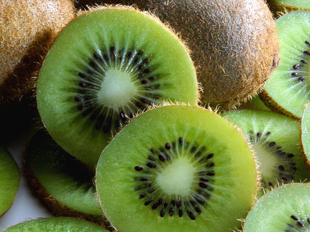Kiwi có thể hỗ trợ giảm cân, kiểm soát lượng đường trong máu. Ảnh Shutterstock