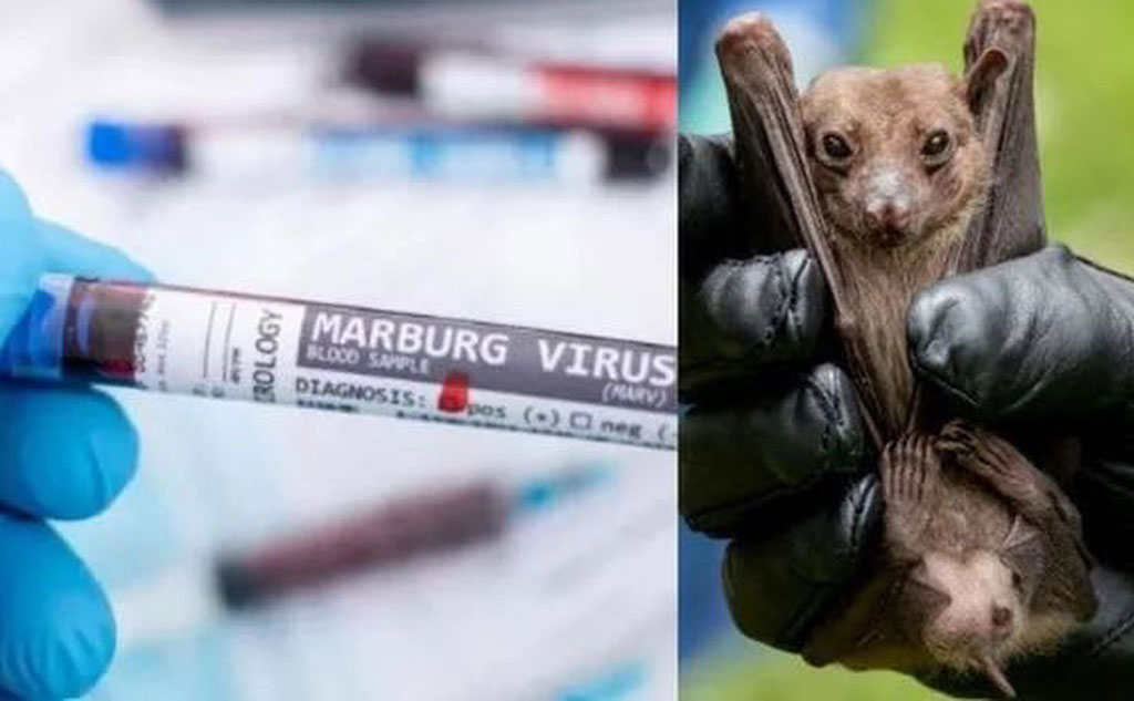 Phòng tránh bệnh do virus Marburg
