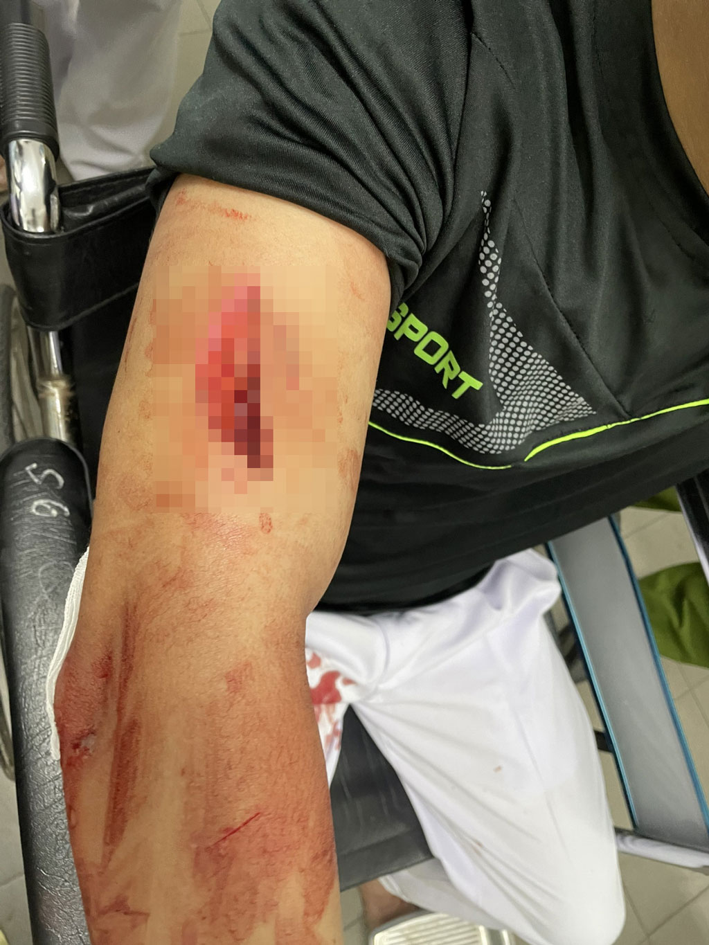 Một nhân viên Bệnh viện Đa khoa Long An bị nhóm 4 đối tượng hành hung