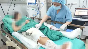 Gần 4.200 lượt khám, cấp cứu nghi do tai nạn giao thông trong ngày thứ 3 nghỉ lễ