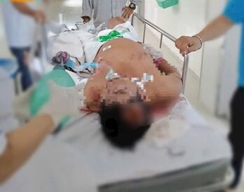 Người đàn ông bị điện giật nguy kịch, gia cảnh khó khăn Người đàn ông bị điện giật nguy kịch, gia cảnh khó khăn